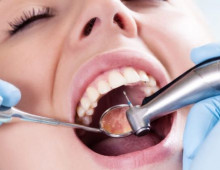 Лечение кариеса: когда идти к стоматологу
